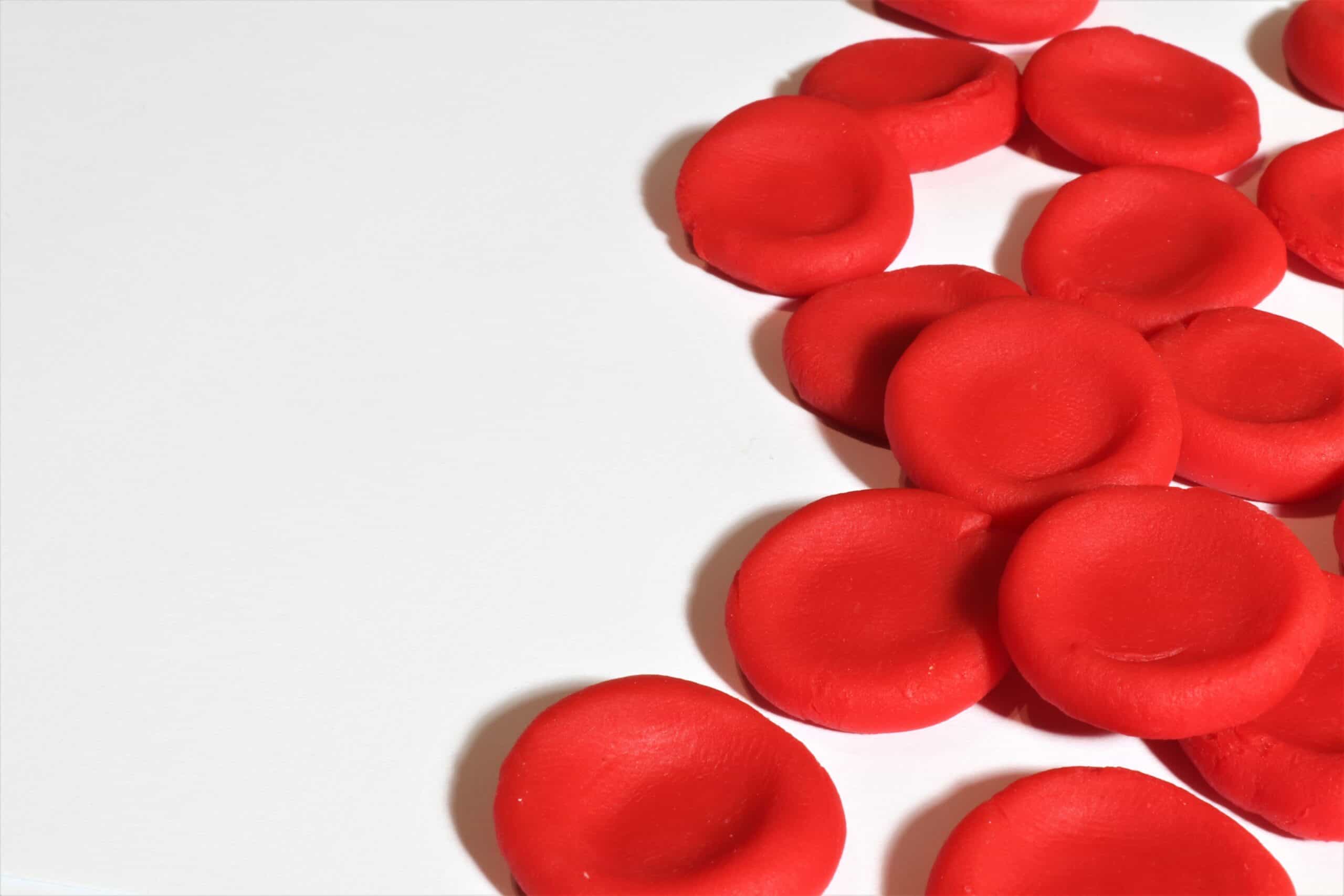 Risk of Bleeding in Patients Undergoing Coronary Interventions on Dual and Triple Therapies: A Retrospective Study