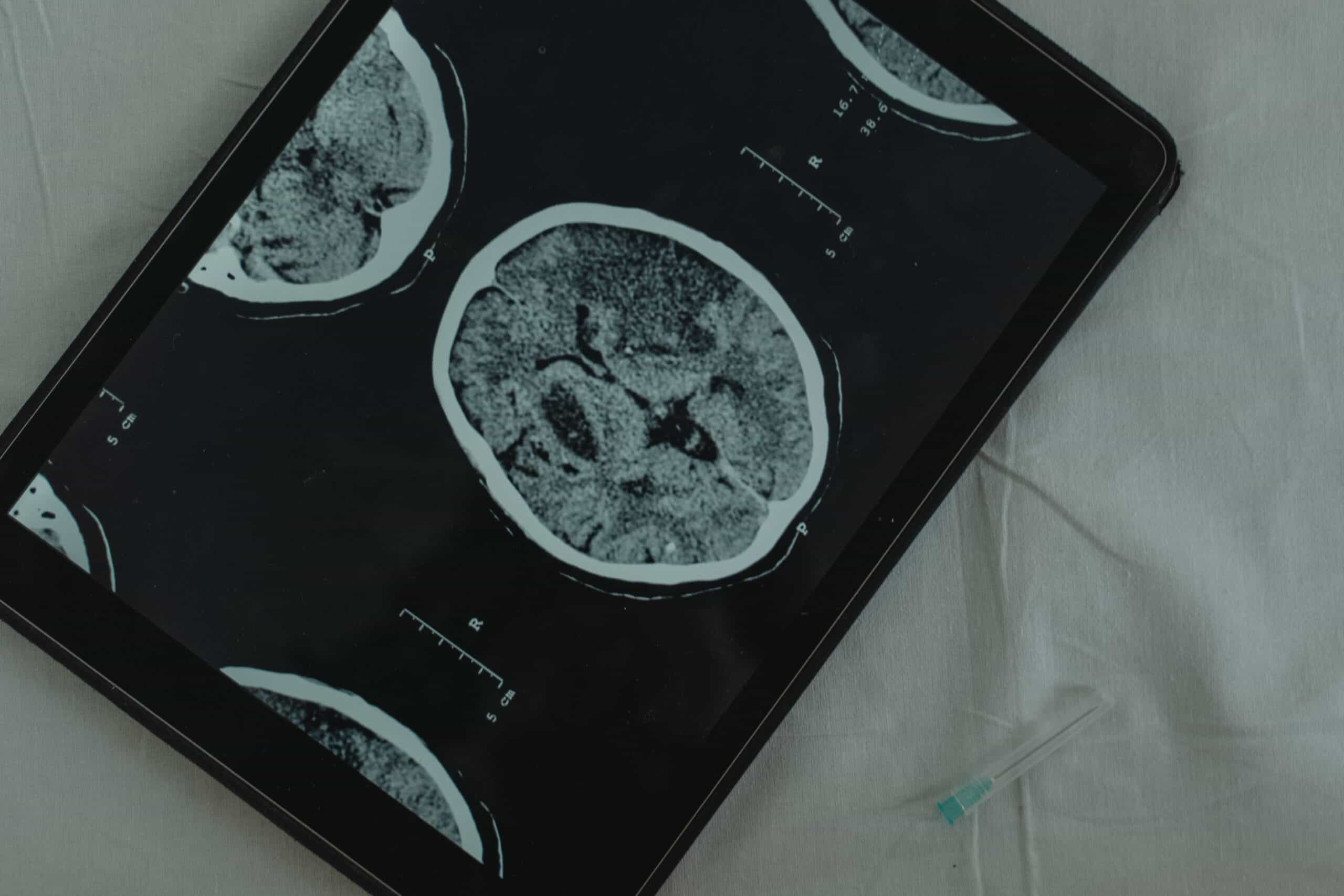 Virtual Care: A New Era in Neurology