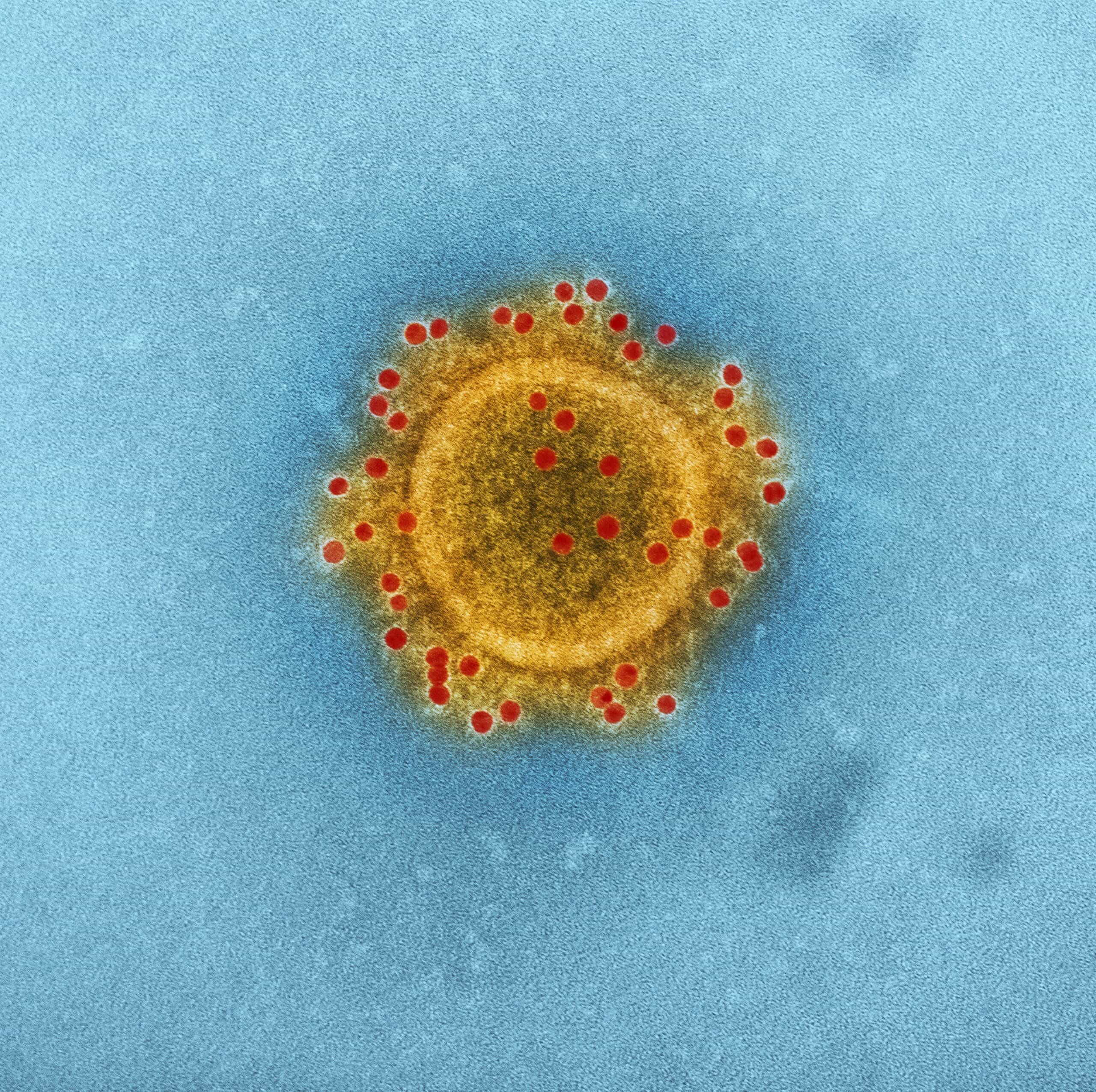 Multiplex Antigen Near-Patient Tests