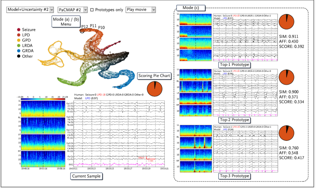 Enhancing Clinician Accuracy in EEG Pattern Classification with AI ...